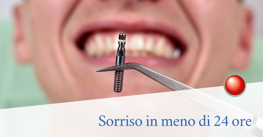 Implantologia a carico immediato, controindicazioni ce ne sono?